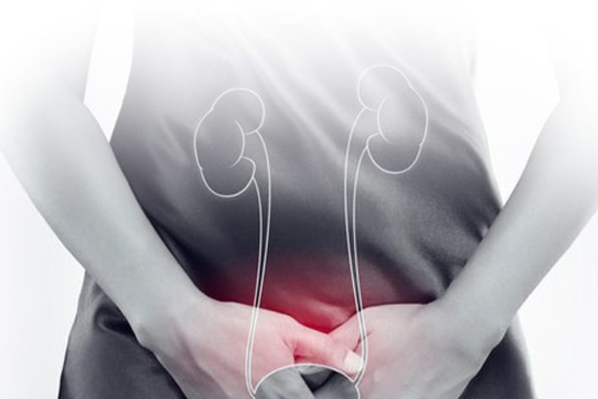 Ağrılı Mesane Tedavisi