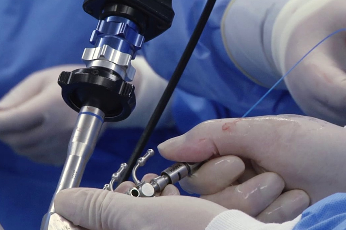 Böbrek Taşı Operasyonu