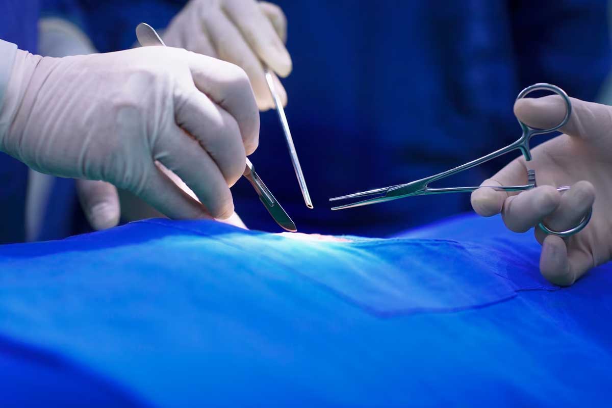 Erkekler İçin Doğum Kontrol Yöntemleri Nelerdir?