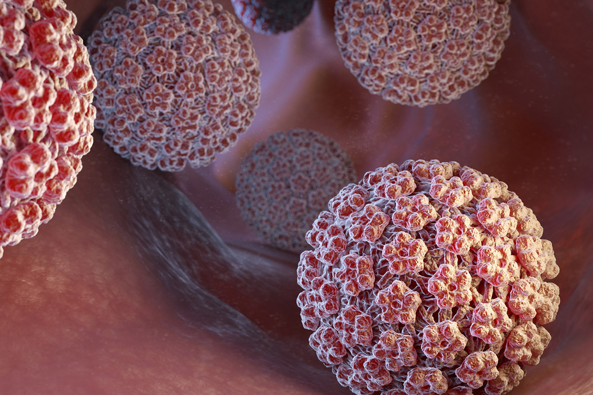 HPV (Genital Siğil)